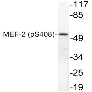 p-MEF-2 (S408) pAb