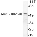 p-MEF-2 (S408) pAb