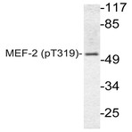 p-MEF-2 (T319) pAb