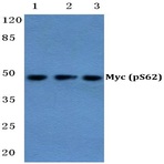 p-Myc (S62) pAb