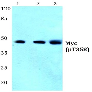 p-Myc (T358) pAb