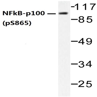 p-NFkB-p100 (S865) pAb