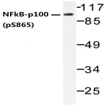 p-NFkB-p100 (S865) pAb