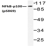 p-NFkB-p100 (S869) pAb