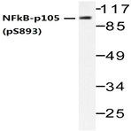 p-NFkB-p105 (S893) pAb