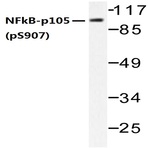 p-NFkB-p105 (S907) pAb