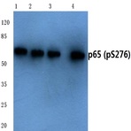 p-NFkB-p65 (S276) pAb