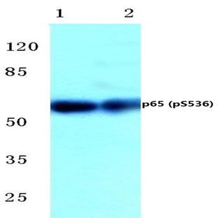 p-NFkB-p65 (S536) pAb