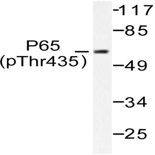 p-NFkB-p65 (T435) pAb