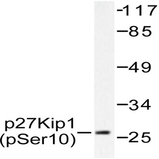 p-p27 Kip1 (S10) pAb