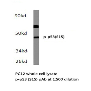 p-p53 (S15) pAb