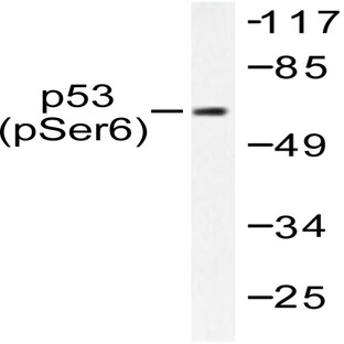 p-p53 (S6) pAb