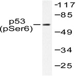 p-p53 (S6) pAb