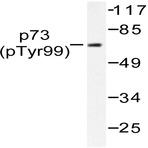 p-p73 (Y99) pAb