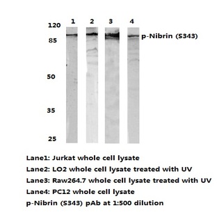 p-Nibrin (S343) pAb