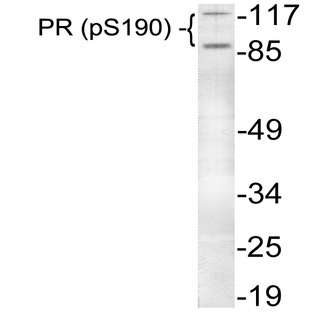 p-PR (S190) pAb