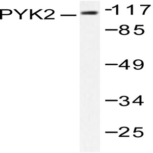 p-PYK2 (Y881) pAb