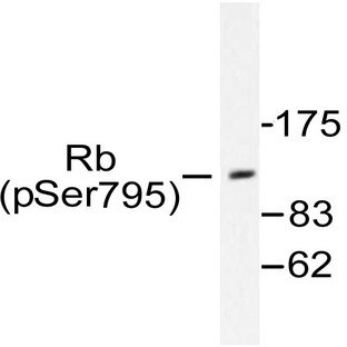 p-Rb (S795) pAb