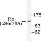 p-Rb (S795) pAb