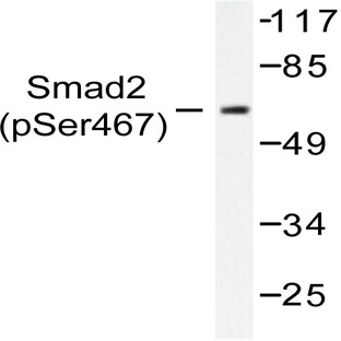 p-Smad2 (S467) pAb