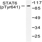 p-Stat6 (Y641) pAb