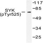 p-Syk (Y525) pAb