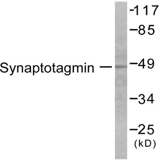 p-Synaptotagmin 1/2 (S309/306) pAb