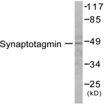 p-Synaptotagmin 1/2 (S309/306) pAb