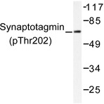 p-Synaptotagmin 1/2 (T202/199) pAb