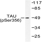 p-Tau (S356) pAb