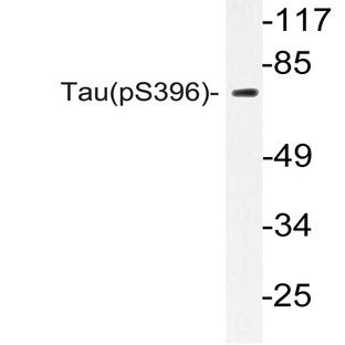 p-Tau (S396) pAb