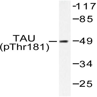 p-Tau (T181) pAb