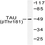 p-Tau (T181) pAb