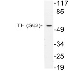 p-TH (S62) pAb