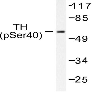 p-TH (S71) pAb