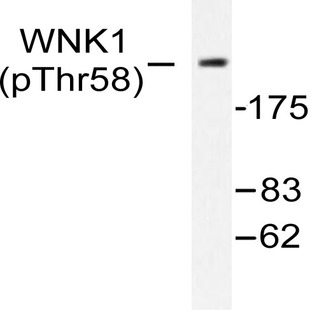 p-WNK1 (T60) pAb