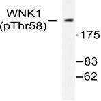 p-WNK1 (T60) pAb