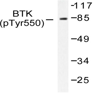 p-BTK (Y551) pAb