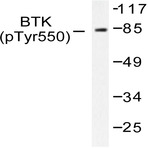 p-BTK (Y551) pAb