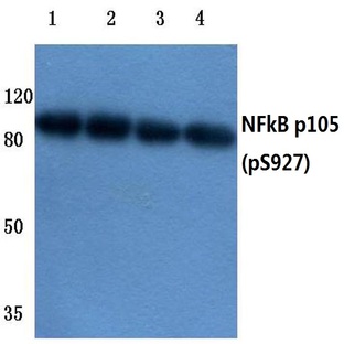 p-NFkB-p105 (S927) pAb