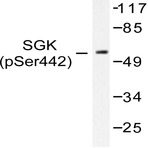 p-SGK (S422) pAb