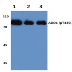 p-Adducin (alpha) (T445) pAb