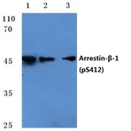 p-Arrestin-(beta)-1 (S412) pAb