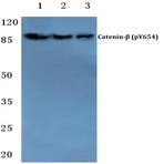 p-Catenin-(beta) (Y654) pAb