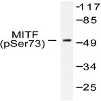 p-MITF (S180) pAb