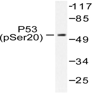 p-p53 (S20) pAb