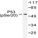 p-p53 (S20) pAb