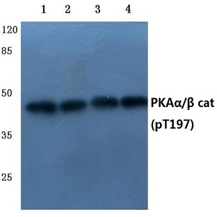 p-PKA(alpha)/(beta) cat (T197) pAb