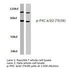 p-PKC (alpha) (T638) pAb