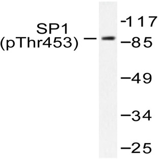 p-Sp1 (T453) pAb